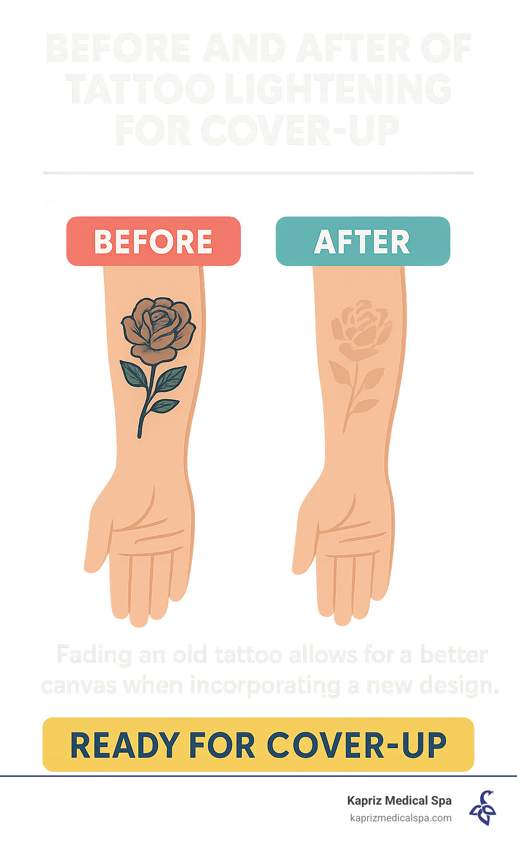 Before and after of tattoo lightening for cover-up - tattoos removal near me infographic