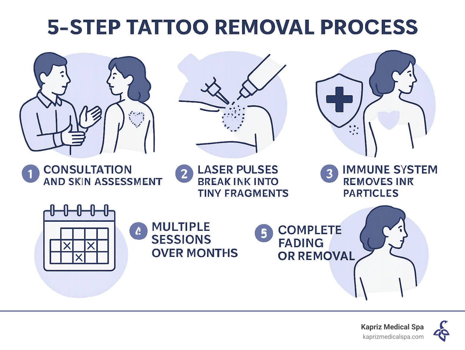 Infographic showing the 5-step tattoo removal process: 1) Consultation and skin assessment 2) Laser pulses break ink into tiny fragments 3) Immune system removes ink particles 4) Multiple sessions over months 5) Complete fading or removal - tattoos removal near me infographic