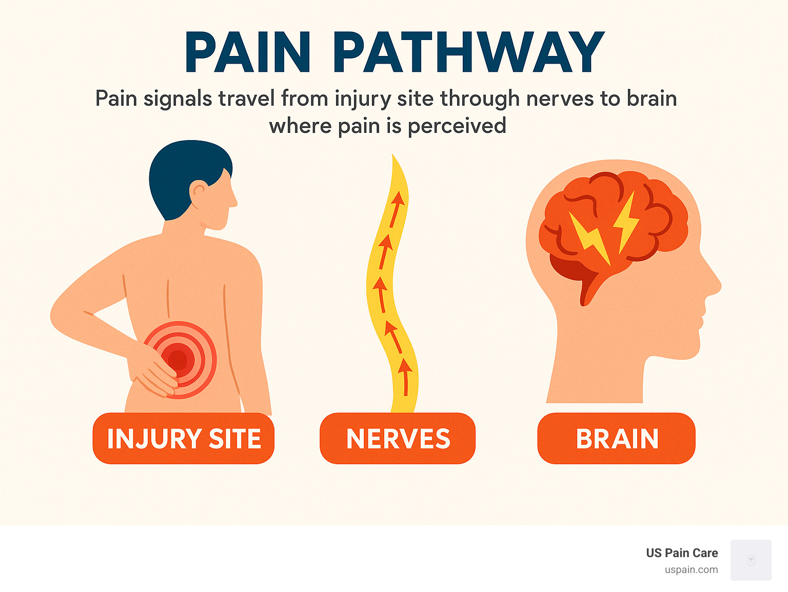 Pain pathway showing how pain signals travel from injury site through nerves to brain where pain is perceived - aches and pains infographic 