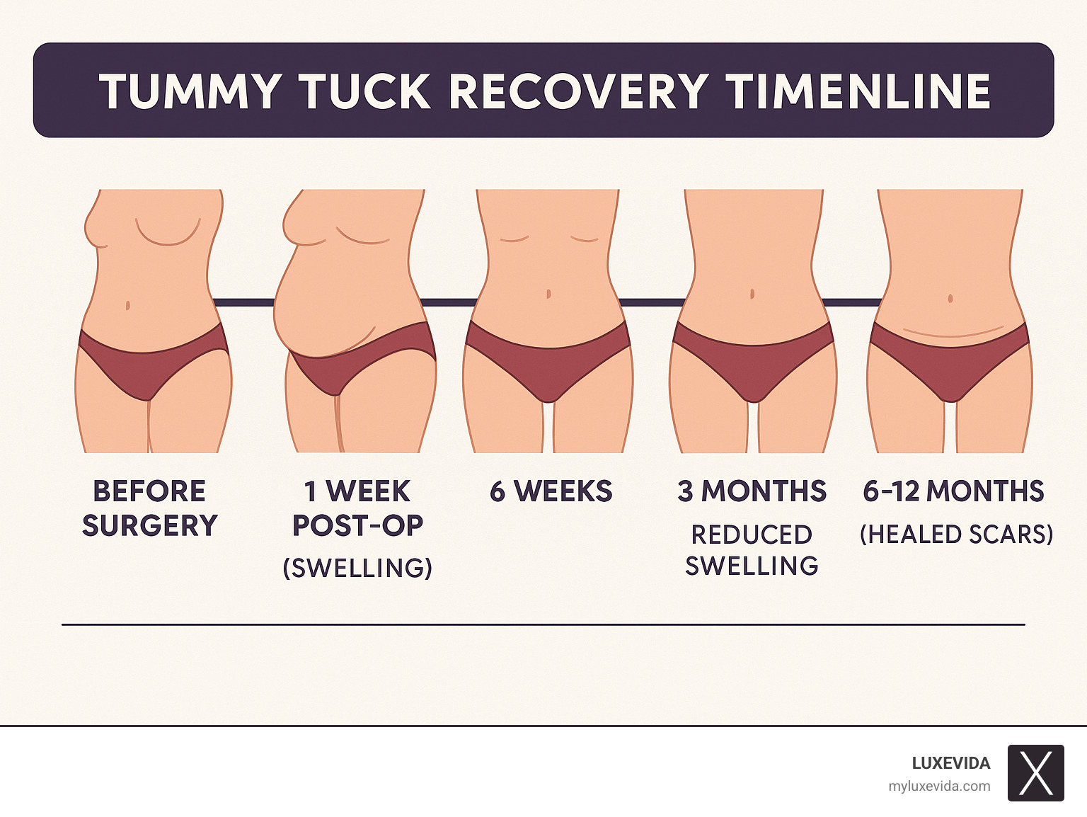 How long does it take to recover from tummy tuck