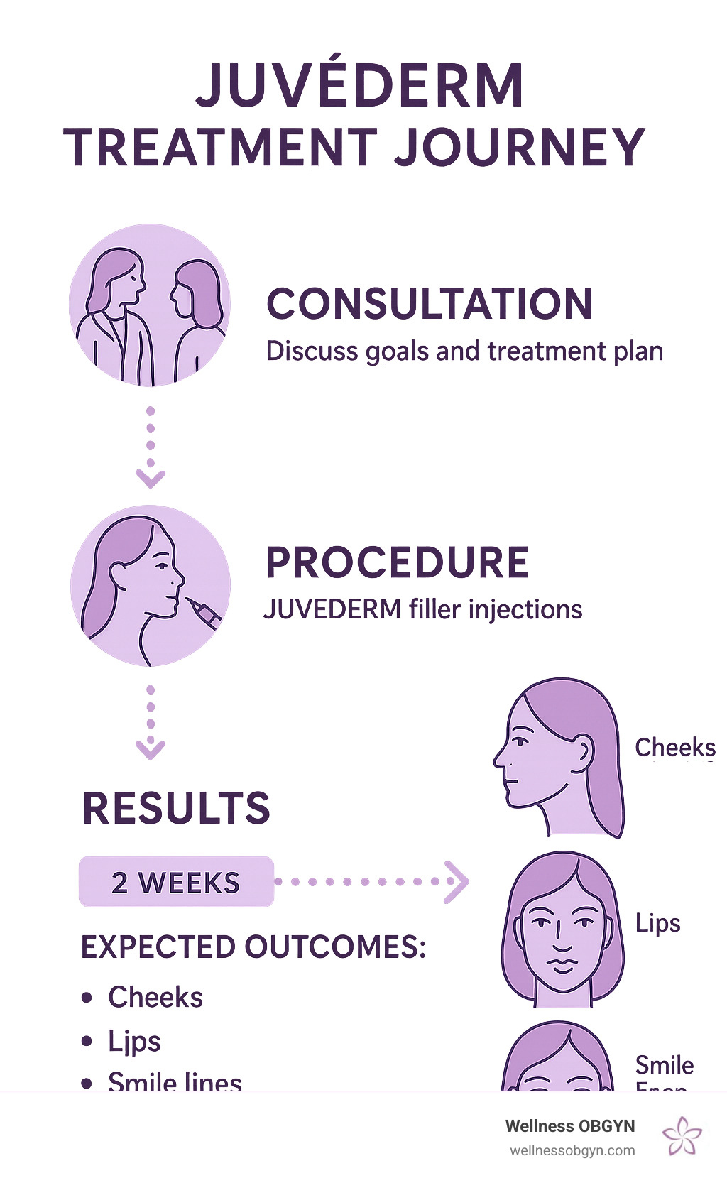 Juvederm treatment journey showing consultation, procedure, and results timeline with expected outcomes for different facial areas - Juvederm infographic 