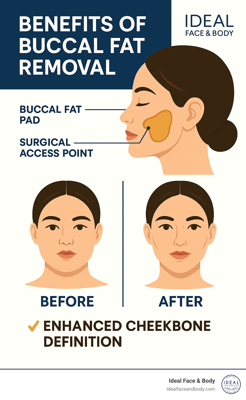 Diagram showing buccal fat pad location in the cheeks, surgical access points, and before/after facial contouring results with improved cheekbone definition - benefits of buccal fat removal infographic 