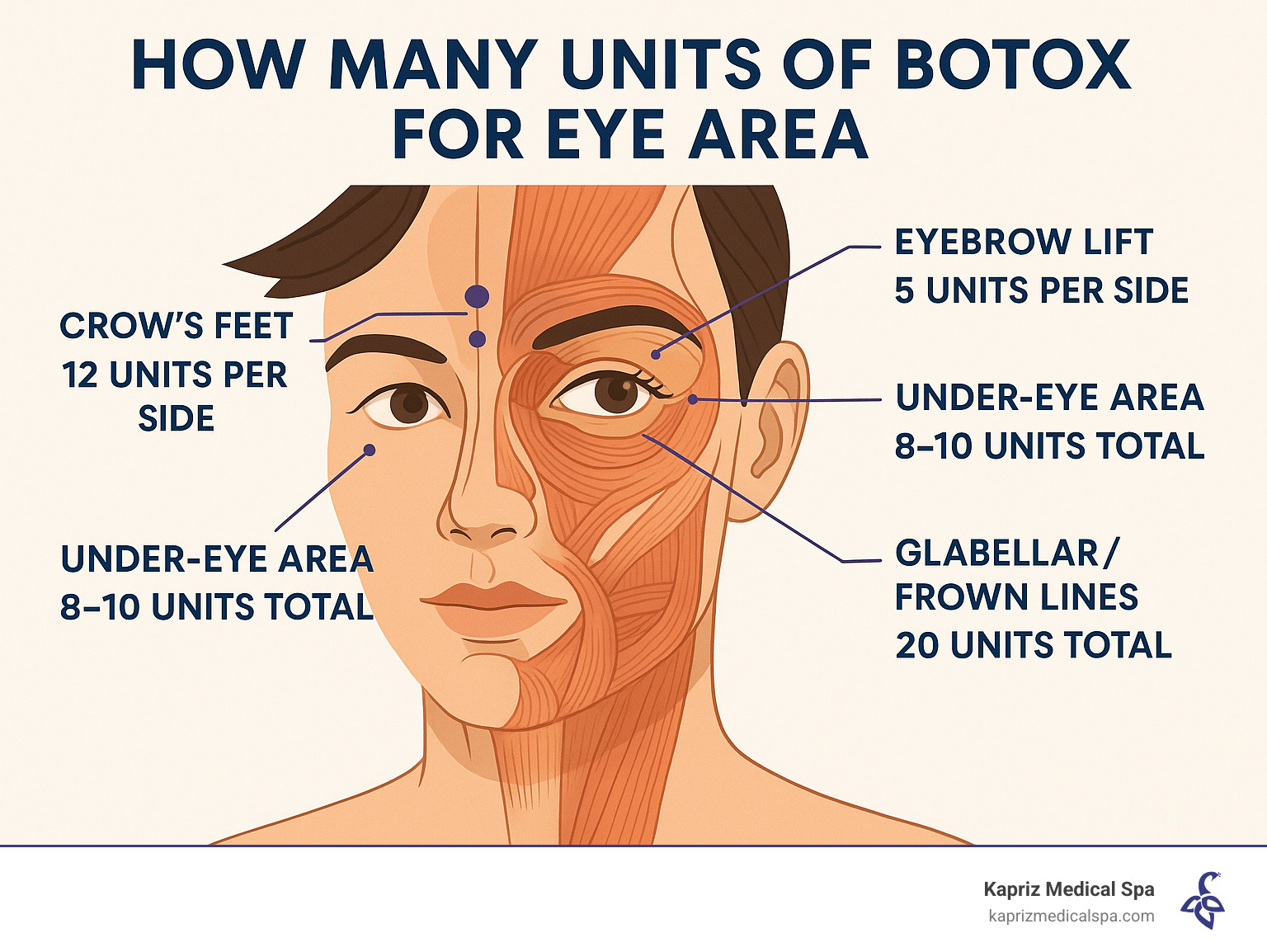 Anatomical diagram of facial muscles around the eyes with labeled injection points showing specific unit dosages for different areas including crow's feet (12 units per side), under-eye area (8-10 units total), eyebrow lift (5 units per side), and glabellar/frown lines (20 units total) - how many units of botox for eye area infographic 