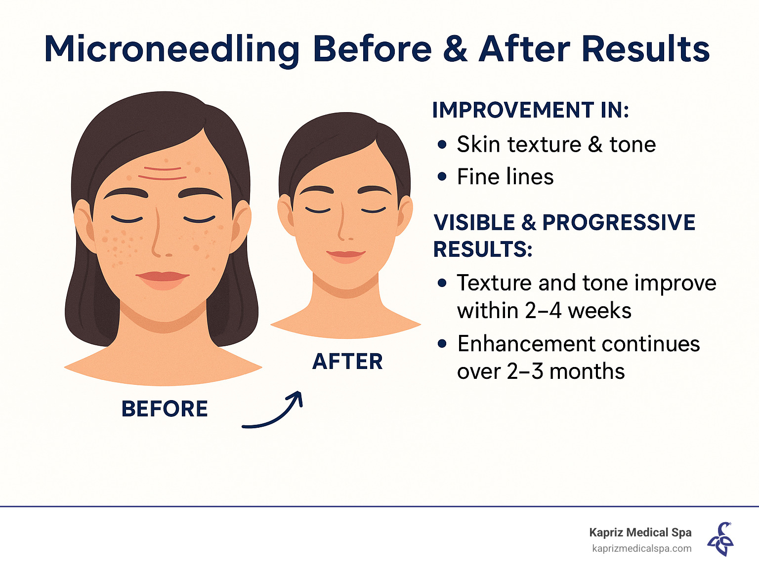 Microneedling before and after results showing improvement in skin texture, tone, and reduction of fine lines - microneedling jacksonville beach fl infographic 
