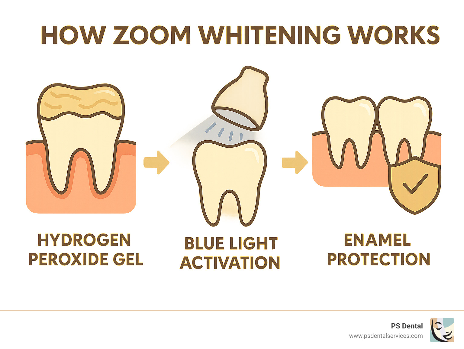 How Zoom whitening works: hydrogen peroxide gel + blue light activation + enamel protection - zoom teeth whitening tigard infographic