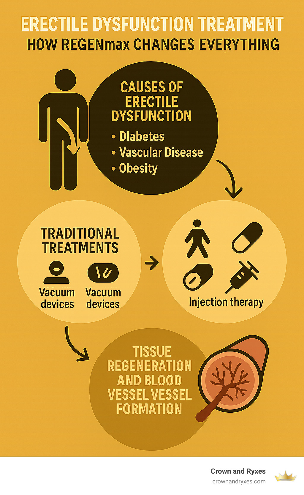 Diagram showing causes of erectile dysfunction, traditional treatments, and how REGENmax works through tissue regeneration and blood vessel formation - erectile dysfunction treatment infographic 