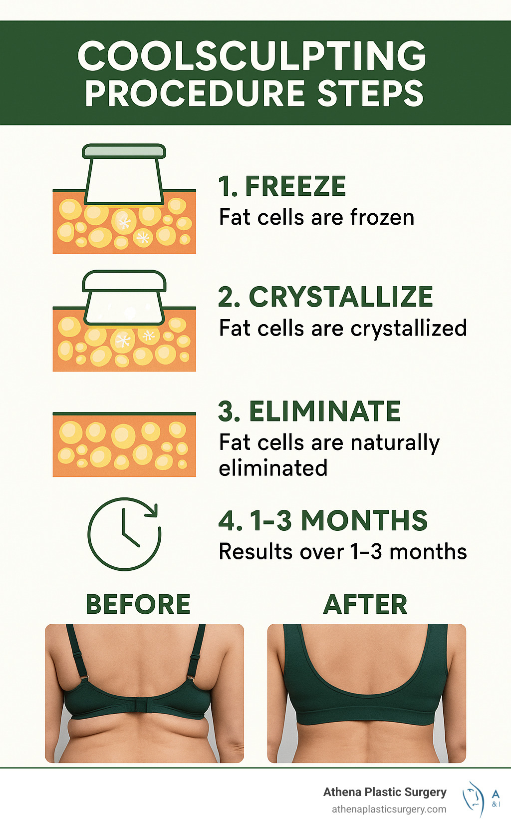 CoolSculpting procedure steps showing how fat cells are frozen, crystallized, and naturally eliminated by the body over 1-3 months, with before and after images of back fat reduction - coolsculpting back fat west palm beach infographic CoolSculpting procedure steps showing how fat cells are frozen, crystallized, and naturally eliminated by the body over 1-3 months, with before and after images of back fat reduction - coolsculpting back fat west palm beach infographic
