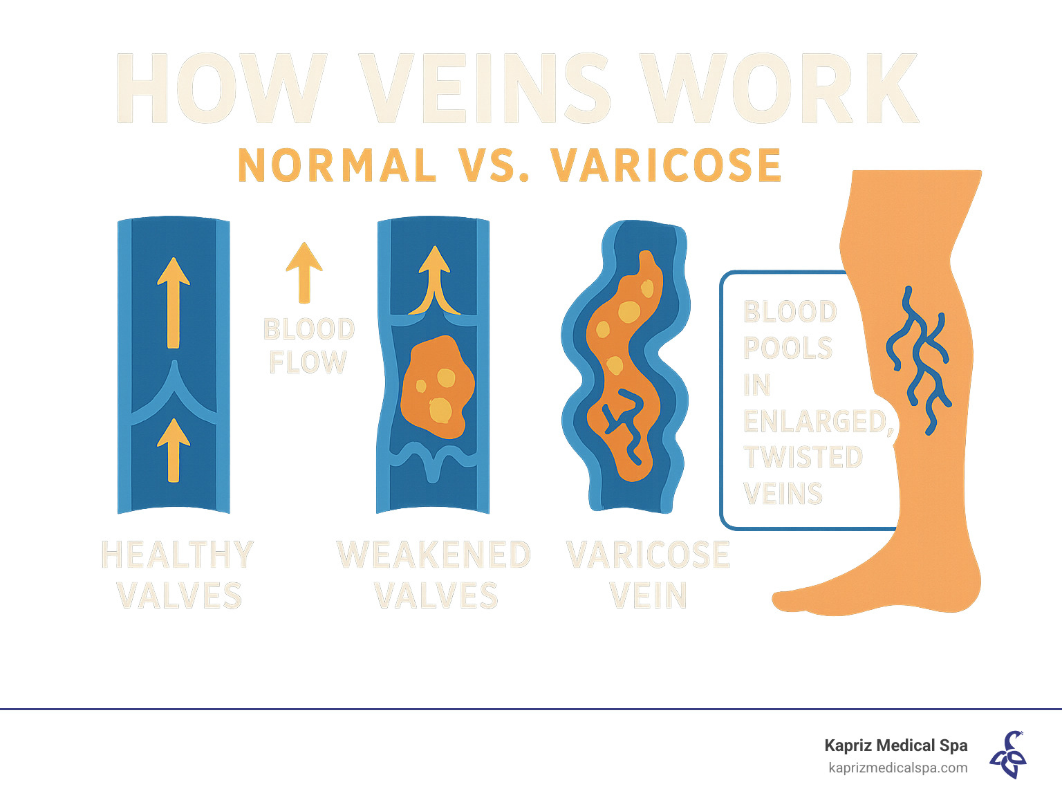how veins work normal vs varicose - Minimally invasive vein treatment infographic