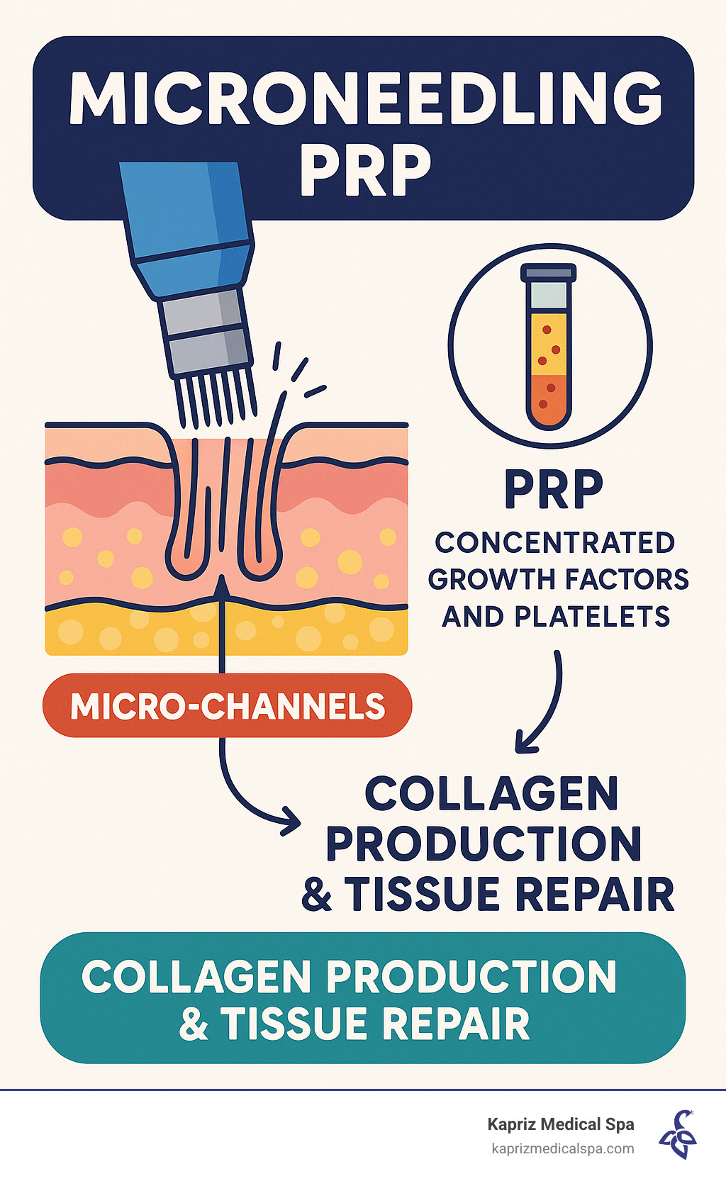 Infographic showing microneedling creating micro-channels in skin layers while PRP delivers concentrated growth factors and platelets for improved collagen production and tissue repair - microneedling prp jacksonville infographic 