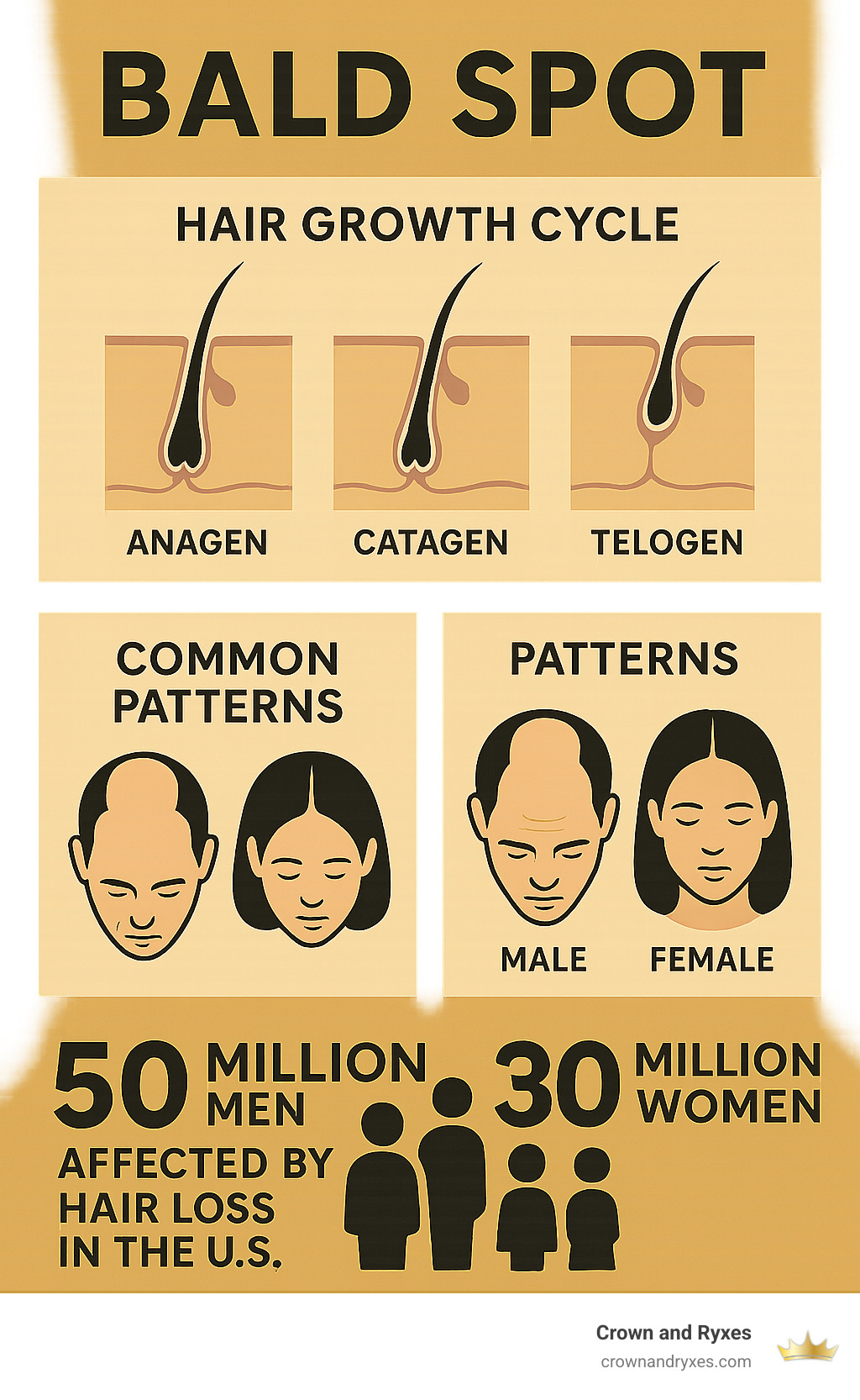 Detailed infographic showing the hair growth cycle with anagen, catagen, and telogen phases, common bald spot patterns on male and female scalps, and statistics showing 50 million men and 30 million women affected by hair loss in the US - bald spot infographic 