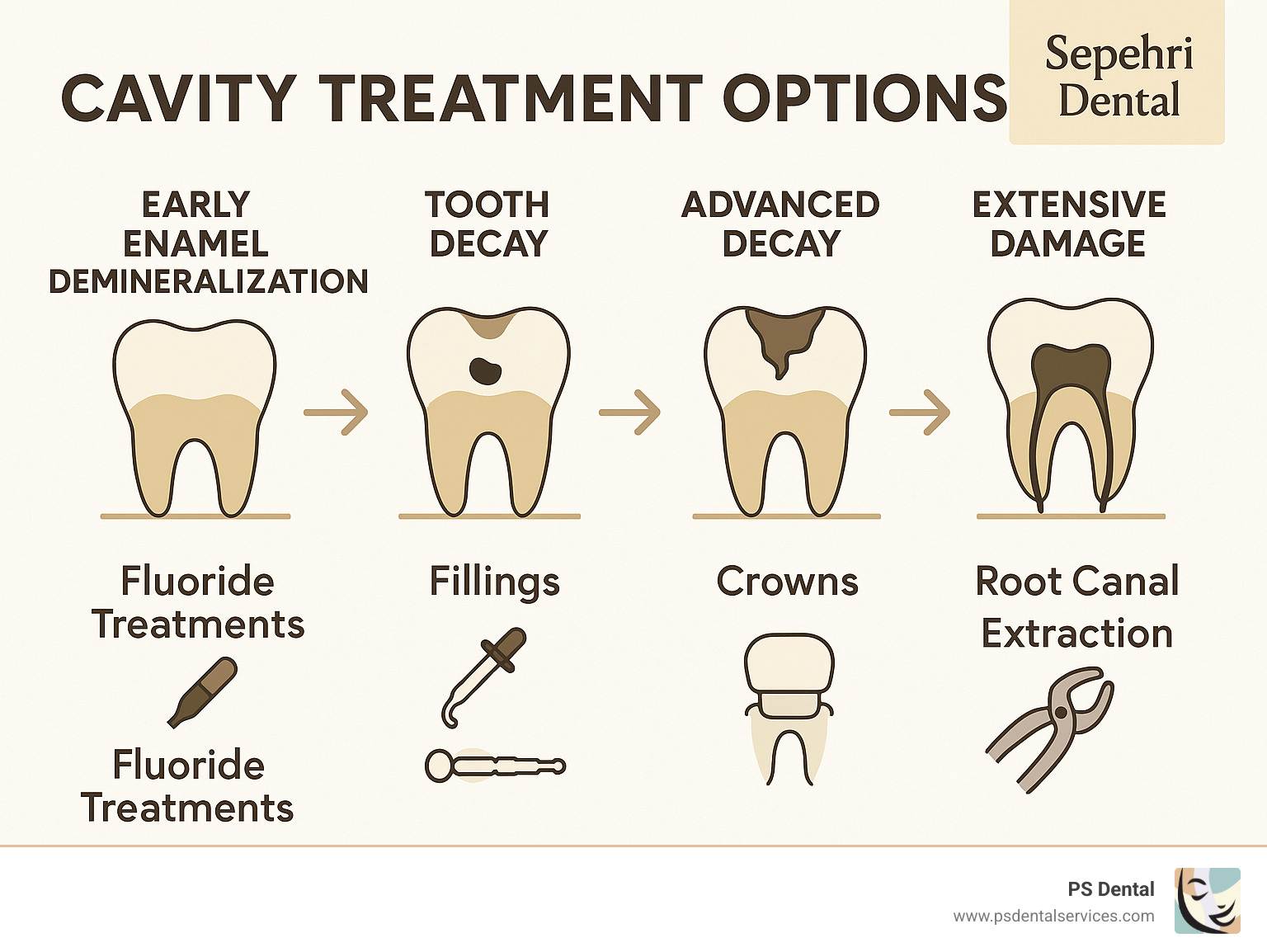 Infographic showing cavity progression from early enamel demineralization through advanced decay requiring extraction, with corresponding treatment options at each stage including fluoride treatments, fillings, crowns, root canals, and implants - cavity treatment options infographic 