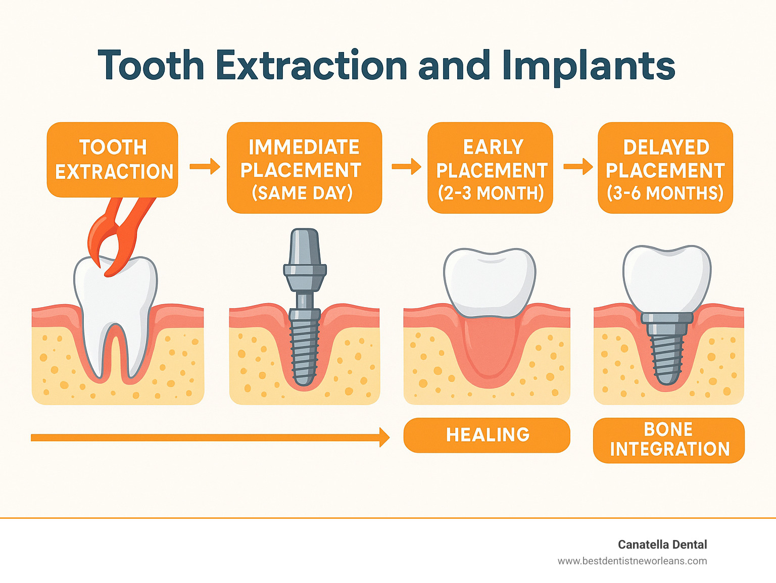 Infographic showing the complete timeline from tooth extraction through implant placement, including immediate placement (same day), early placement (2-3 months), and delayed placement (3-6 months), with healing milestones and bone integration phases clearly marked - Tooth extraction and implants infographic 