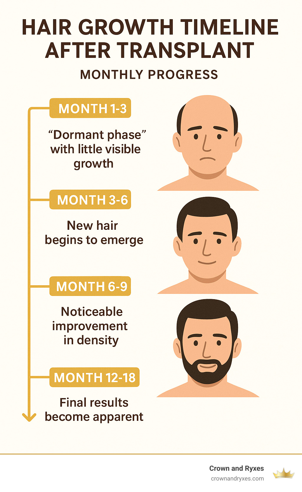hair growth timeline after transplant showing monthly progress - hair restoration surgery near me infographic