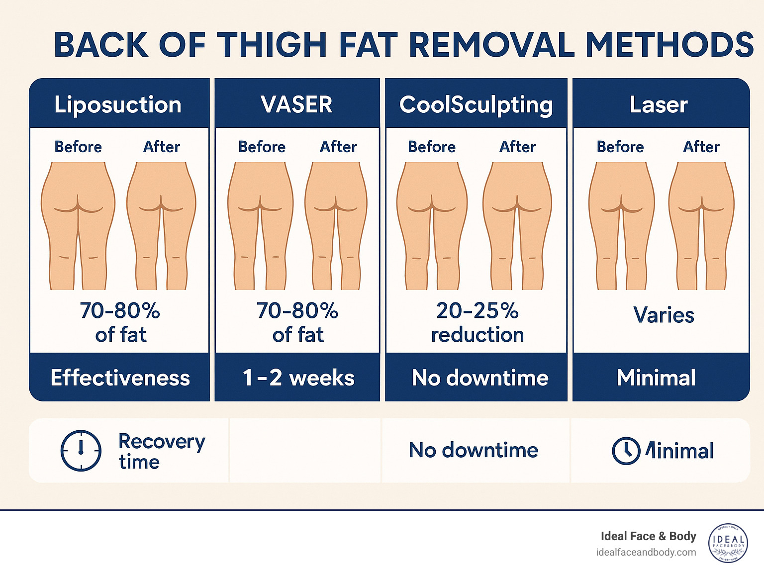 Comparison of back of thigh fat removal methods showing liposuction, VASER, CoolSculpting, and laser treatments with their effectiveness rates, recovery times, and before/after visual examples - back of thigh fat removal infographic 