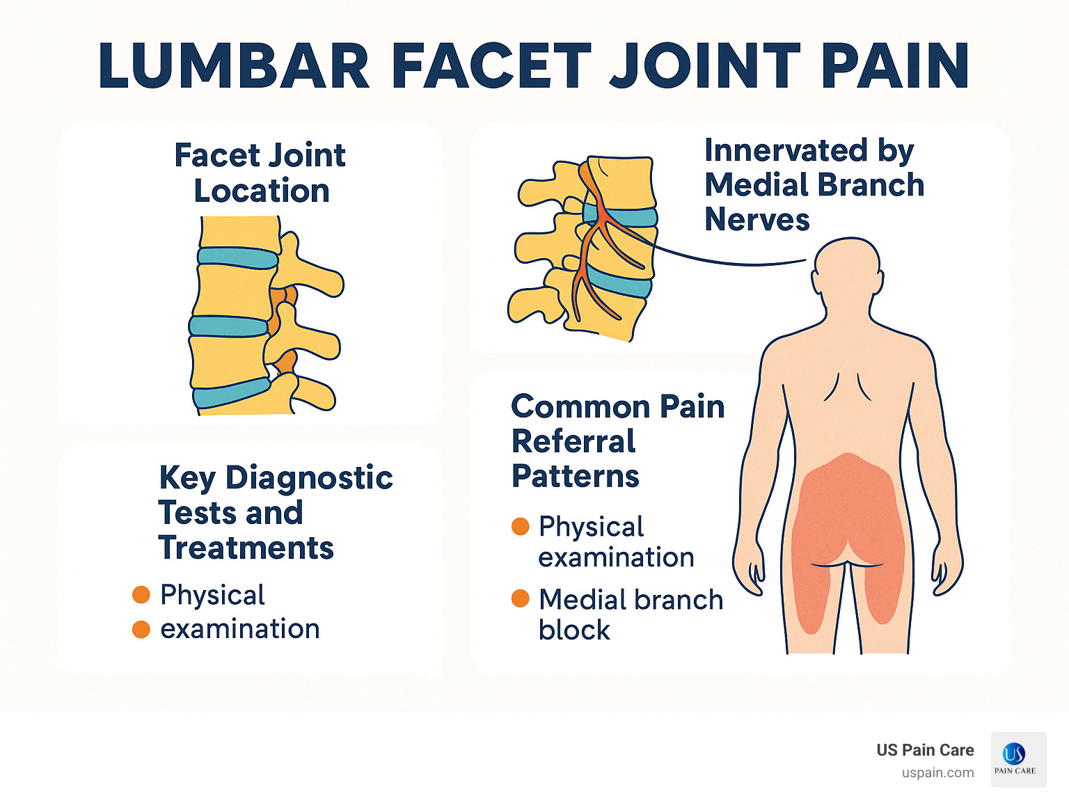 Lumbar facet joint pain diagram showing facet joint location, innervation by medial branch nerves, common pain referral patterns, and key diagnostic tests and treatments - lumbar facet joint pain infographic Lumbar facet joint pain diagram showing facet joint location, innervation by medial branch nerves, common pain referral patterns, and key diagnostic tests and treatments - lumbar facet joint pain infographic