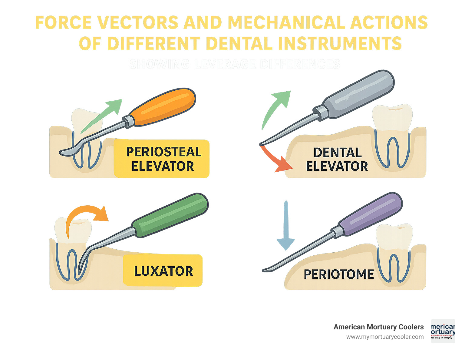 Force vectors and mechanical actions of different dental instruments showing leverage differences - periosteel elevator infographic 