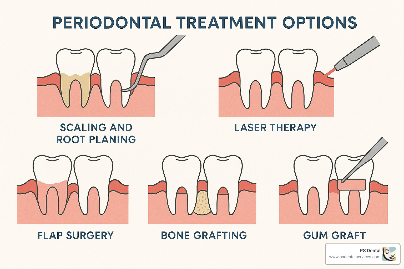 periodontal treatment options - best gum disease treatment
