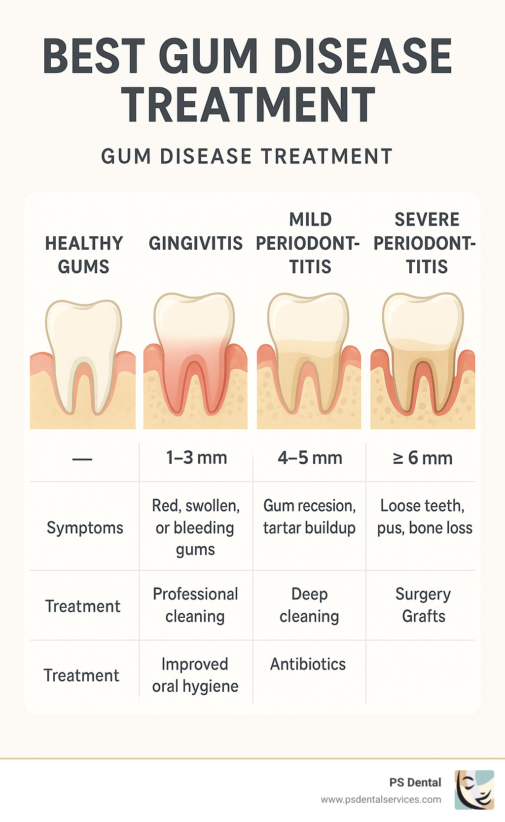 Infographic showing the four stages of gum disease from healthy gums to gingivitis to mild periodontitis to severe periodontitis, with pocket depths, symptoms, and treatment options for each stage - best gum disease treatment infographic 