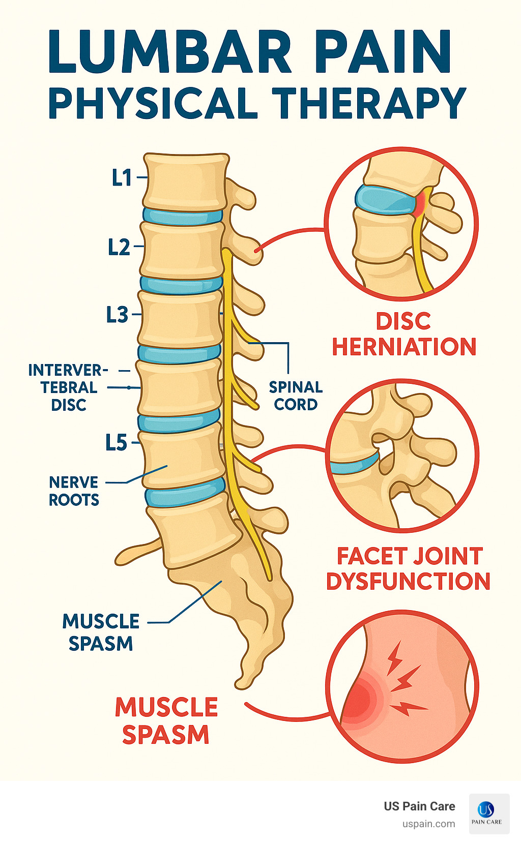 Infographic showing lumbar spine anatomy with vertebrae L1-L5, intervertebral discs, spinal cord, nerve roots, and common pain pathways including disc herniation, facet joint dysfunction, and muscle spasm patterns affecting the lower back - lumbar pain physical therapy infographic 