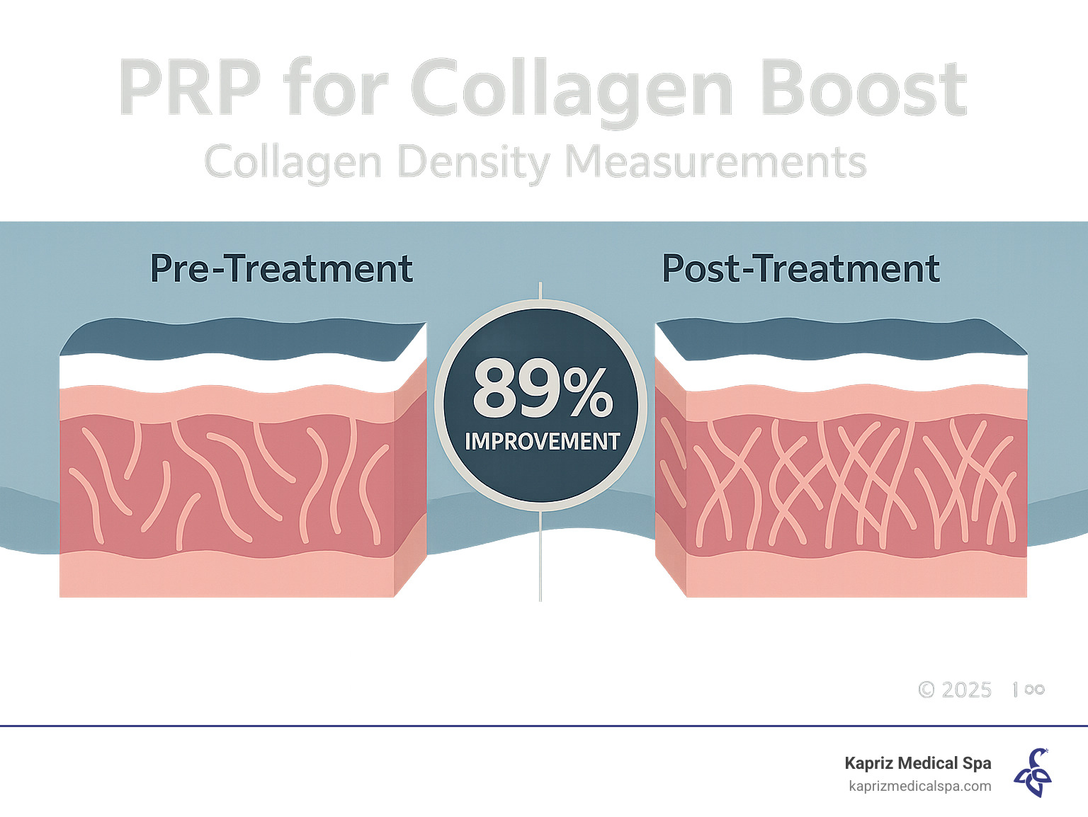 Infographic comparing pre-treatment vs post-treatment collagen density measurements showing 89% improvement - PRP for collagen boost infographic