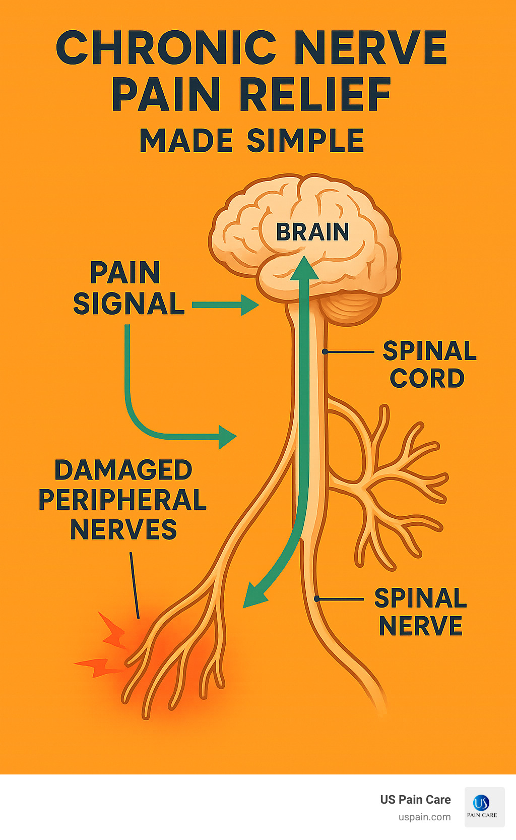 Detailed infographic showing the nerve pain signaling pathway from damaged peripheral nerves through the spinal cord to the brain, with labeled anatomical structures and pain signal transmission routes - chronic nerve pain relief infographic 