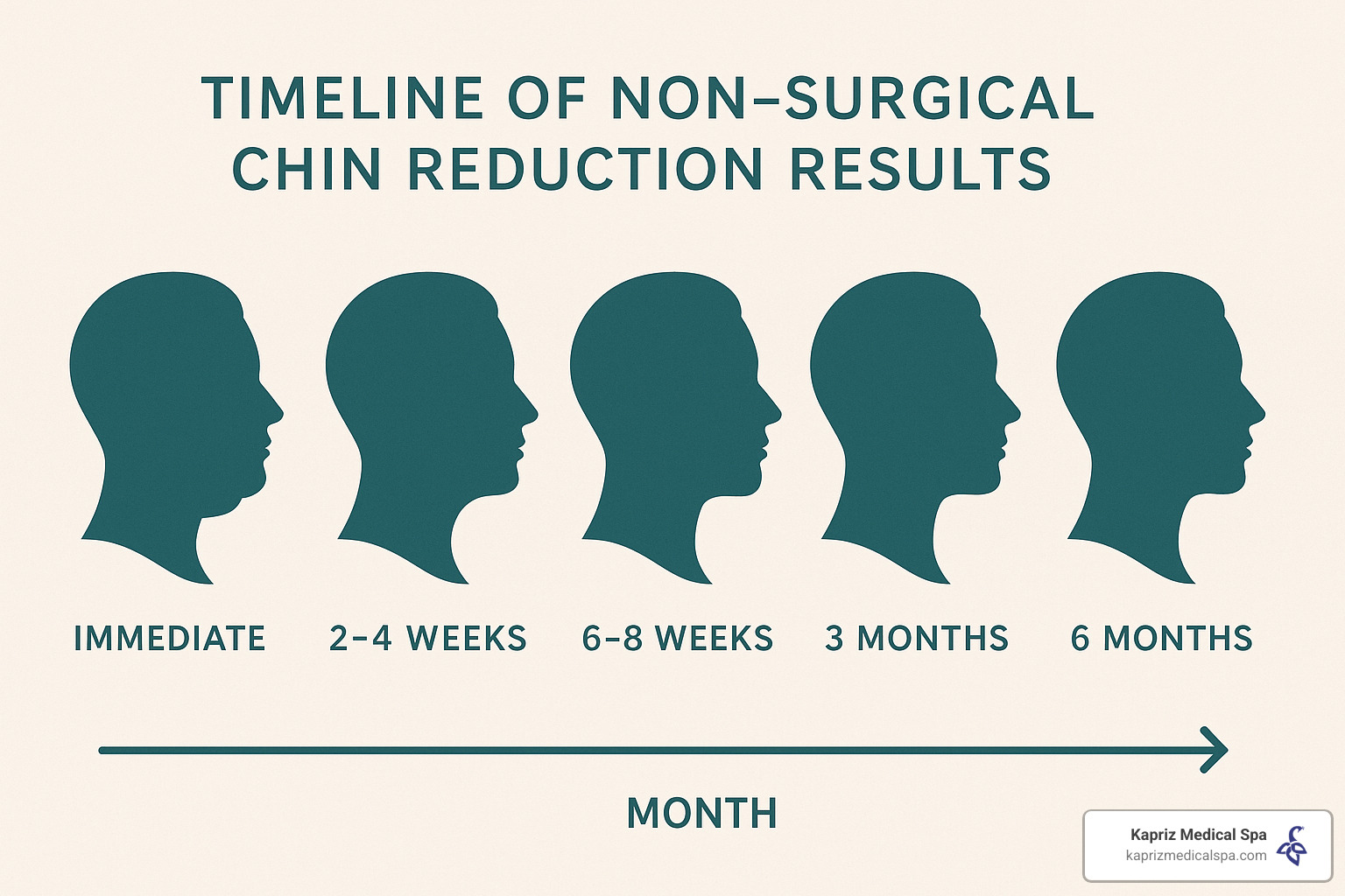 timeline showing progression of chin reduction results over 6 months - Non surgical chin reduction