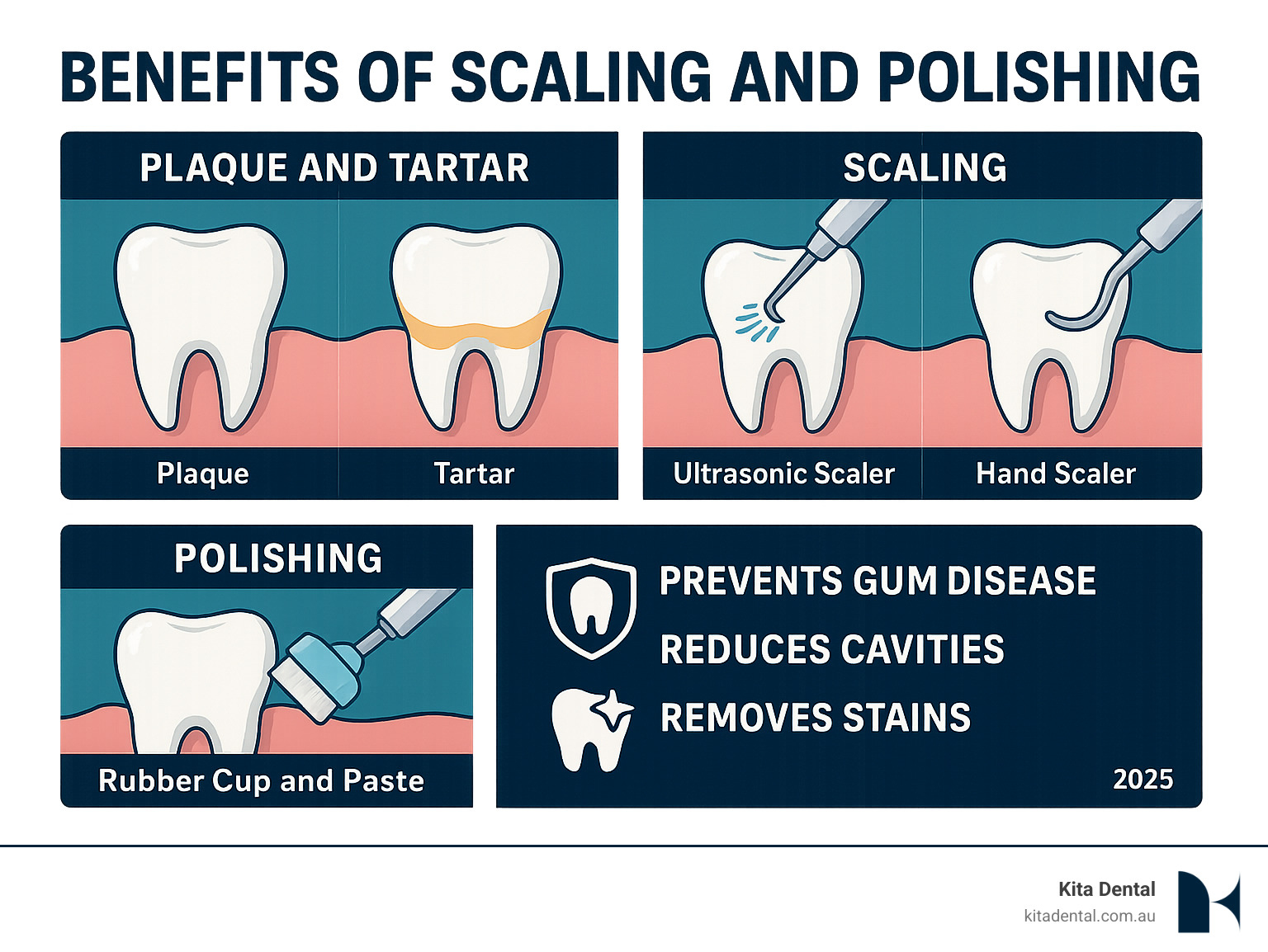 Comprehensive infographic showing the difference between plaque and tartar buildup on teeth, the scaling process using ultrasonic and manual instruments, followed by polishing with rubber cup and paste, highlighting benefits like gum disease prevention, cavity reduction, and stain removal for Australian dental patients - benefits of scaling and polishing infographic