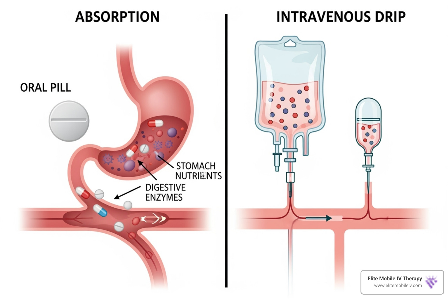 illustration showing the difference between oral supplement digestion and direct IV infusion into the bloodstream - immune booster infusion