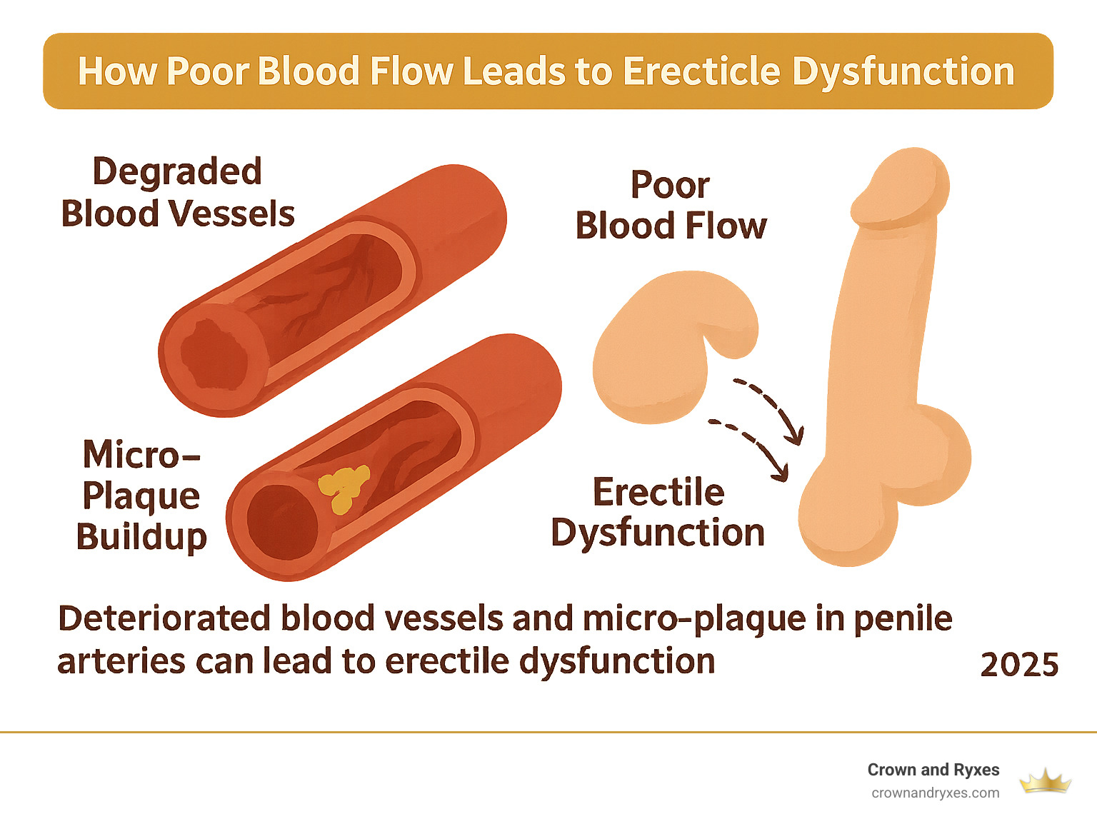 Comprehensive infographic showing how poor blood flow from deteriorated blood vessels and micro-plaque buildup in penile arteries leads to erectile dysfunction, with visual representation of blocked vs healthy blood vessels and the impact on erection quality - shockwave therapy for ed in the villages infographic Comprehensive infographic showing how poor blood flow from deteriorated blood vessels and micro-plaque buildup in penile arteries leads to erectile dysfunction, with visual representation of blocked vs healthy blood vessels and the impact on erection quality - shockwave therapy for ed in the villages infographic