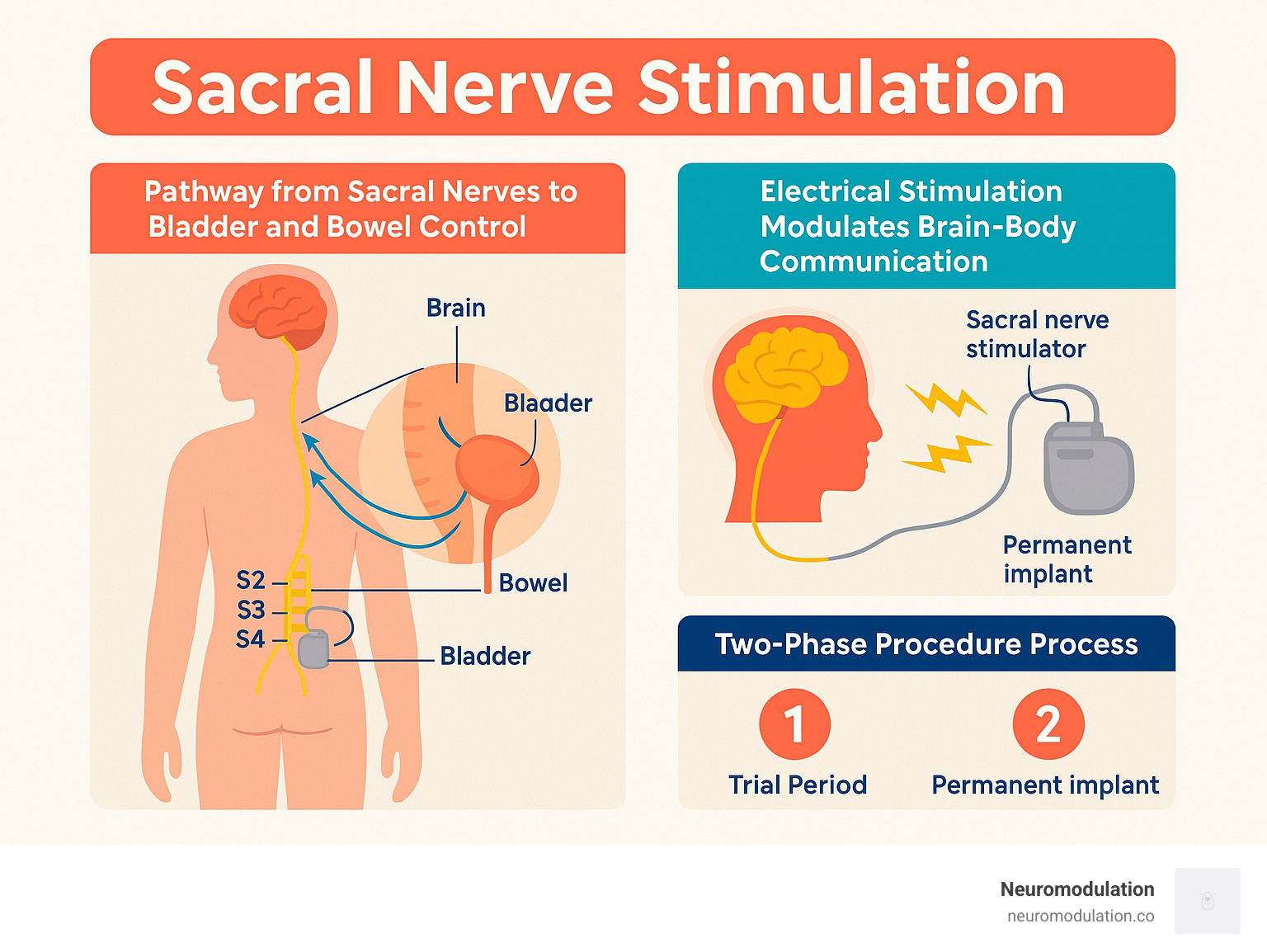 Infographic explaining the communication pathway between the sacral nerves, bladder, and bowel