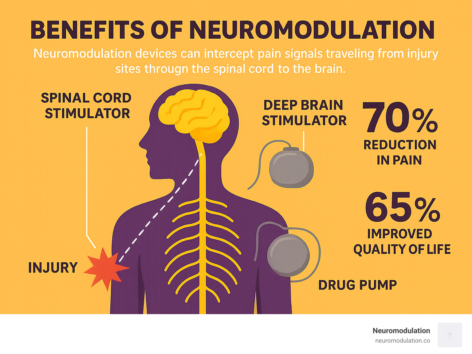 Comprehensive infographic showing how neuromodulation devices intercept pain signals traveling from injury sites through the spinal cord to the brain, with visual representations of spinal cord stimulators, deep brain stimulators, and drug pumps, alongside statistics on pain reduction and quality of life improvements - Benefits of neuromodulation infographic 