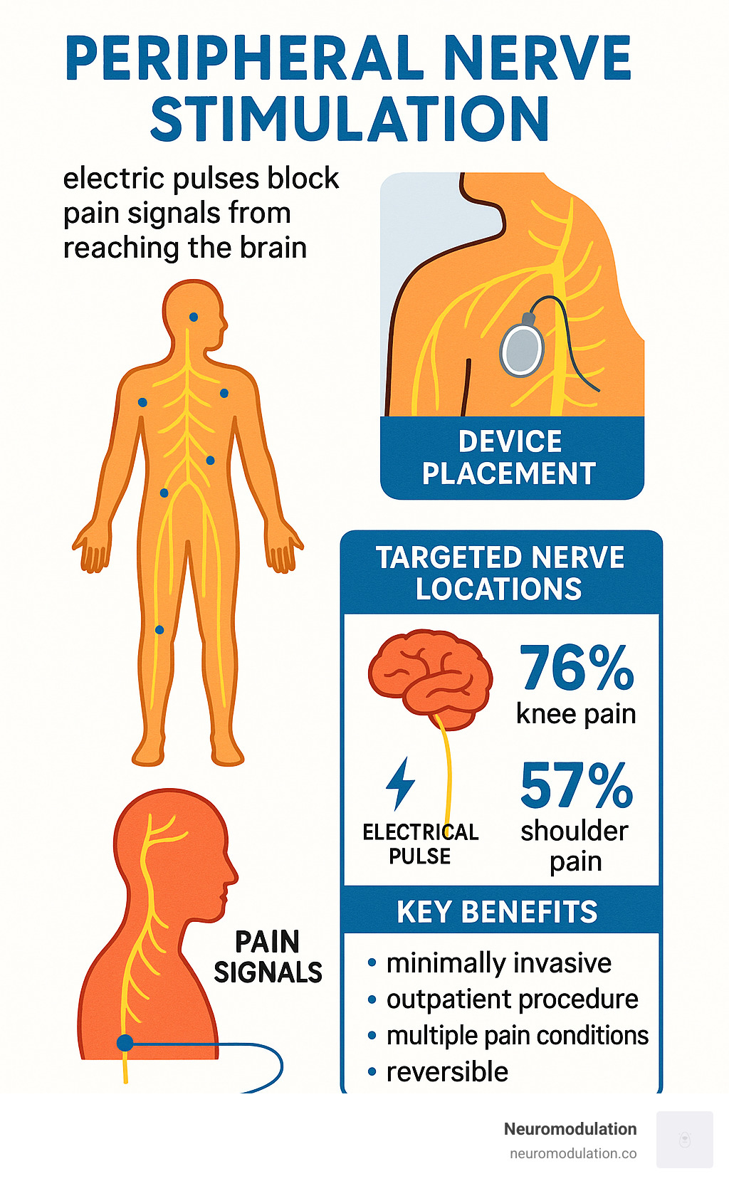 Comprehensive overview of peripheral nerve stimulation showing the device placement process, targeted nerve locations throughout the body, and how electrical pulses interrupt pain signals from reaching the brain, with success rates and key benefits highlighted - peripheral nerve stimulation (pns) infographic 