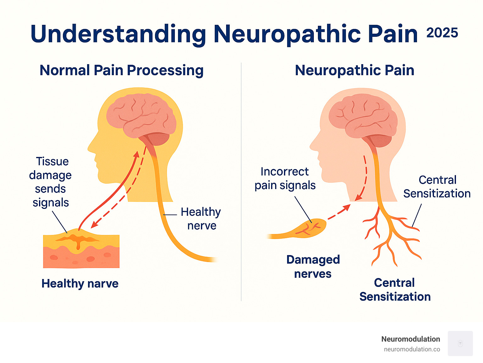 Infographic showing the difference between normal pain processing where tissue damage sends signals through healthy nerves to the brain, versus neuropathic pain where damaged nerves send incorrect pain signals even without tissue damage, highlighting the key mechanisms of peripheral and central sensitization - neuropathic pain infographic 