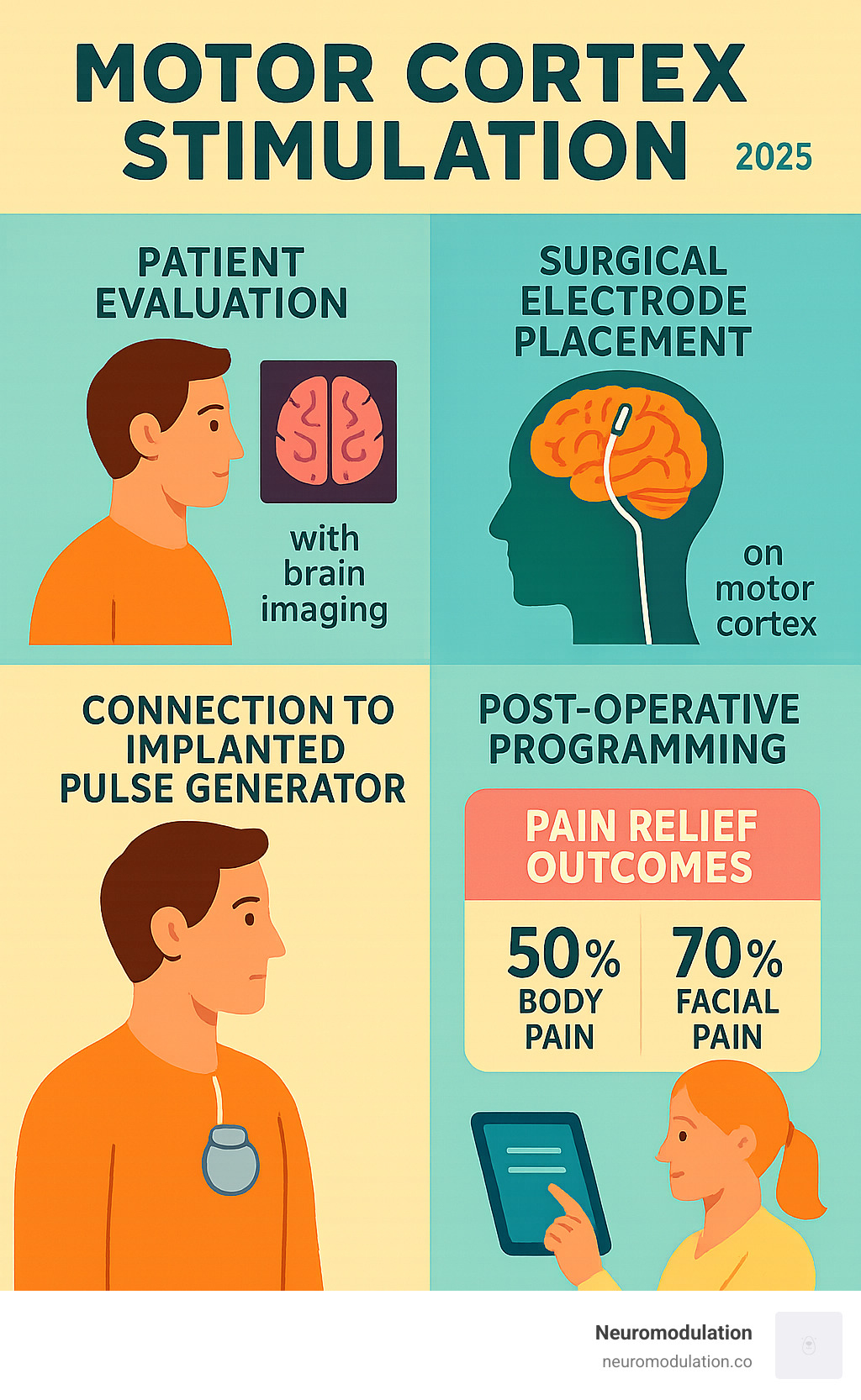 Comprehensive infographic showing motor cortex stimulation procedure steps: patient evaluation with brain imaging, surgical electrode placement on motor cortex, connection to implanted pulse generator, and post-operative programming with pain relief outcomes statistics - motor cortex stimulation infographic 