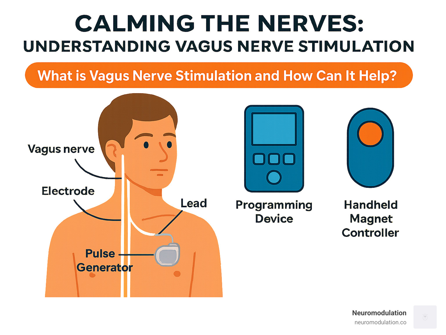 Comprehensive VNS system infographic showing pulse generator placement in upper chest, lead wire routing through neck, and electrode connection to left vagus nerve, with programming device and handheld magnet controller - vagus nerve stimulation (vns) infographic 