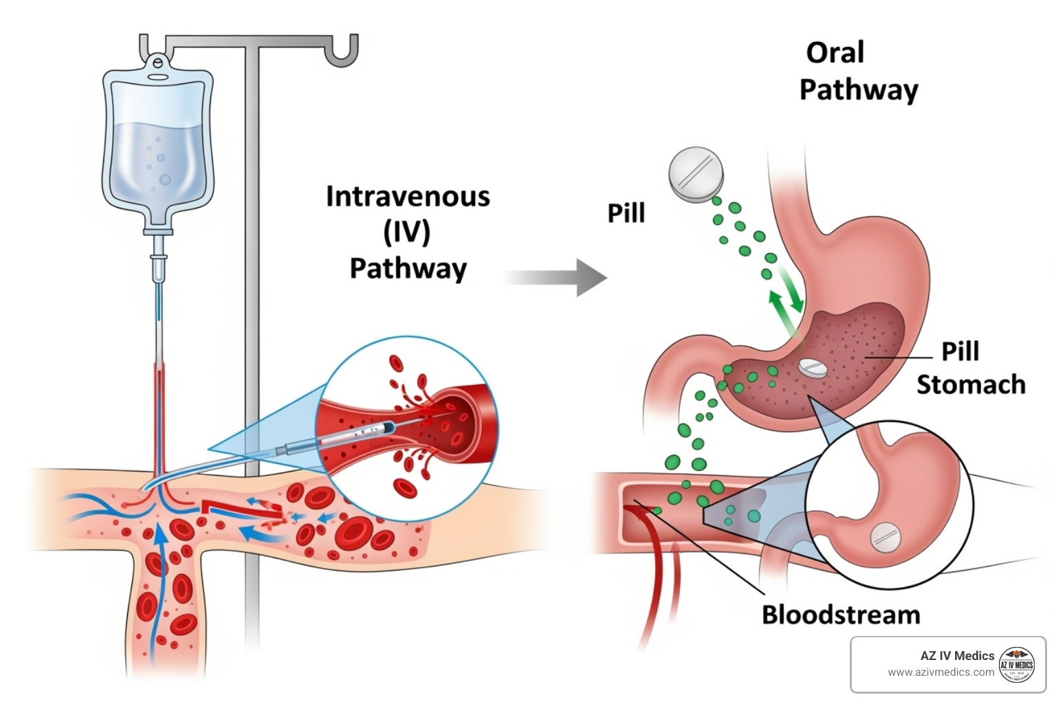 diagram showing IV delivery directly into the bloodstream vs. oral medication passing through the stomach - migraine iv