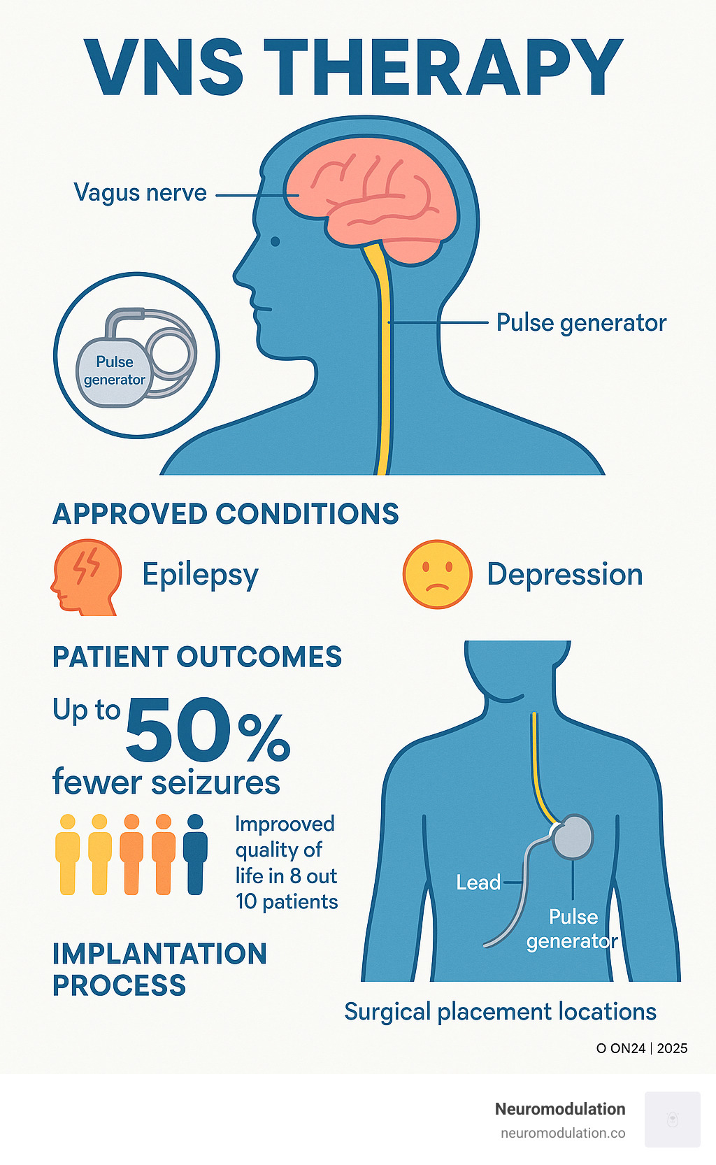 Comprehensive overview of VNS therapy showing the vagus nerve pathway from neck to brain, device components including pulse generator and leads, approved conditions like epilepsy and depression, patient outcomes statistics, and the implantation process with surgical placement locations - vns infographic Comprehensive overview of VNS therapy showing the vagus nerve pathway from neck to brain, device components including pulse generator and leads, approved conditions like epilepsy and depression, patient outcomes statistics, and the implantation process with surgical placement locations - vns infographic