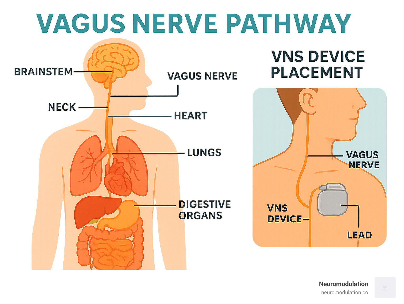Detailed infographic showing the vagus nerve pathway from brainstem through neck to chest and abdomen, with connections to heart, lungs, and digestive organs, plus VNS device placement illustration - vagal nerve stimulator infographic 
