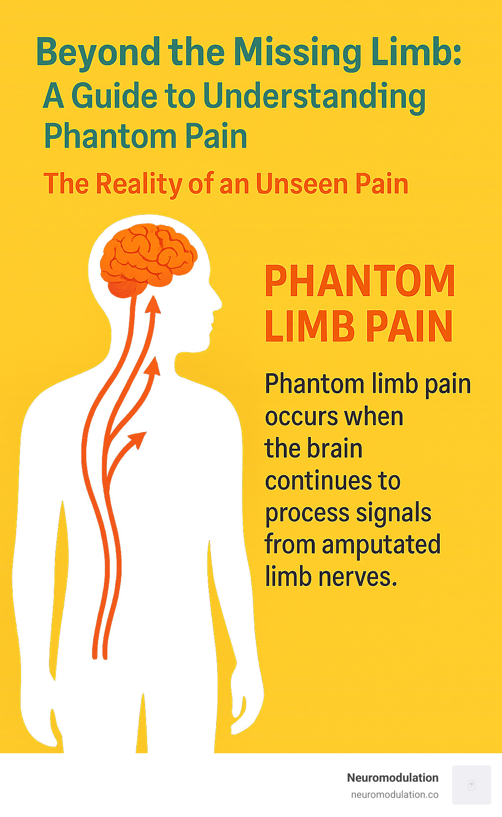 Detailed infographic showing a human silhouette with brain highlighted, arrows indicating nerve pathways from a missing limb area to the brain, with text explaining how phantom limb pain occurs when the brain continues to process signals from amputated limb nerves - phantom limb pain infographic Detailed infographic showing a human silhouette with brain highlighted, arrows indicating nerve pathways from a missing limb area to the brain, with text explaining how phantom limb pain occurs when the brain continues to process signals from amputated limb nerves - phantom limb pain infographic