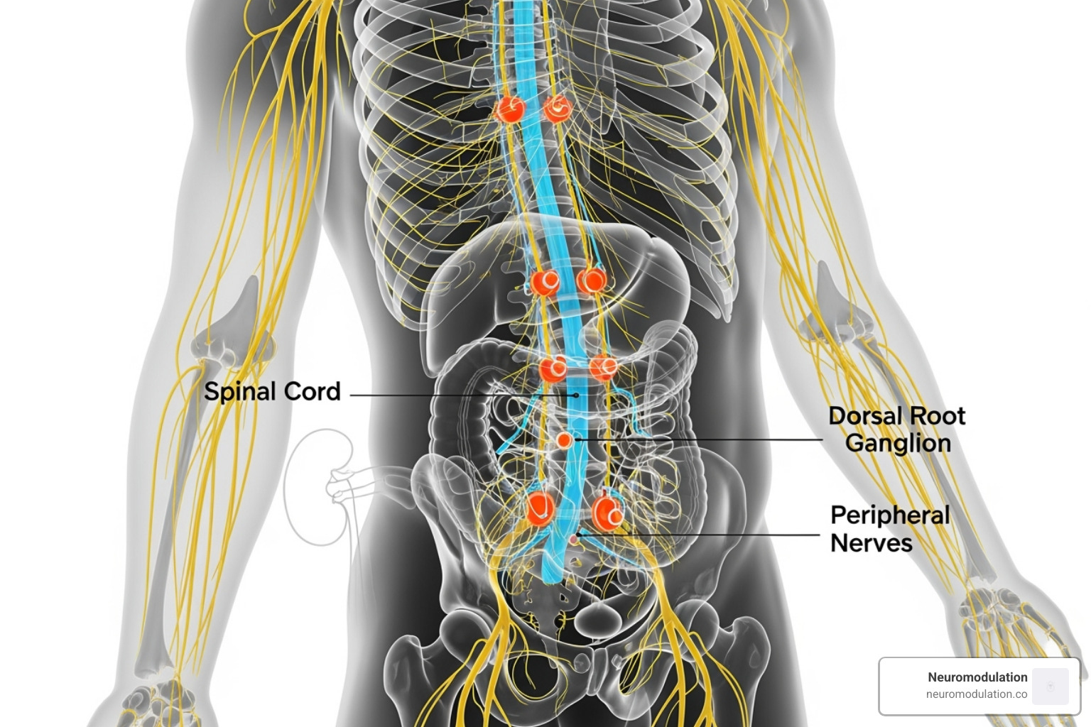 Diagram showing locations of different neuromodulation device placements, including the spinal cord, dorsal root ganglia, and peripheral nerves - neuromodulation for chronic pain