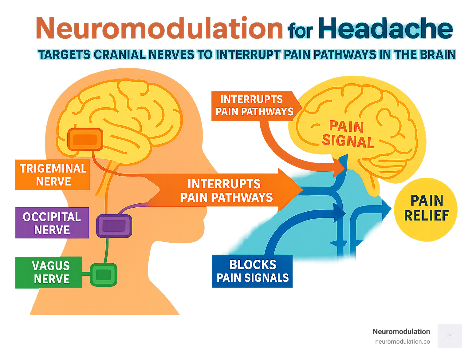 Comprehensive infographic showing how neuromodulation devices target different cranial nerves (trigeminal, occipital, vagus) to interrupt pain pathways in the brain, with arrows indicating signal blocking and pain relief mechanisms - neuromodulation for headache infographic 