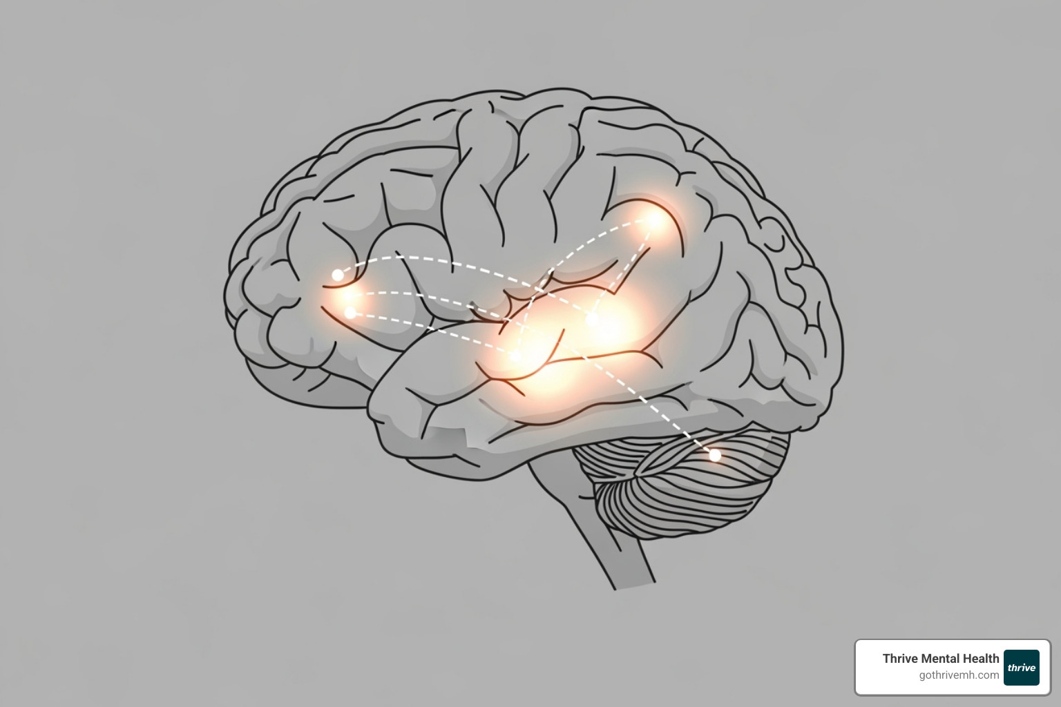 illustrating the brain's fear response circuit (amygdala, hippocampus, prefrontal cortex) - PTSD