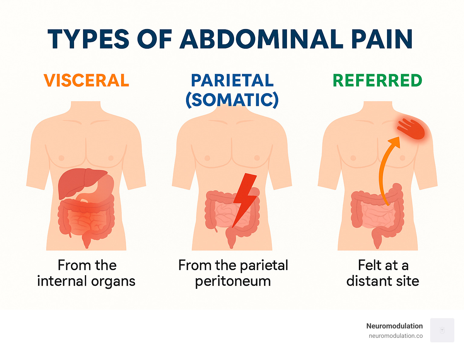Infographic explaining the types of abdominal pain: Visceral, Parietal/Somatic, and Referred - abdominal pain management algorithm infographic Infographic explaining the types of abdominal pain: Visceral, Parietal/Somatic, and Referred - abdominal pain management algorithm infographic