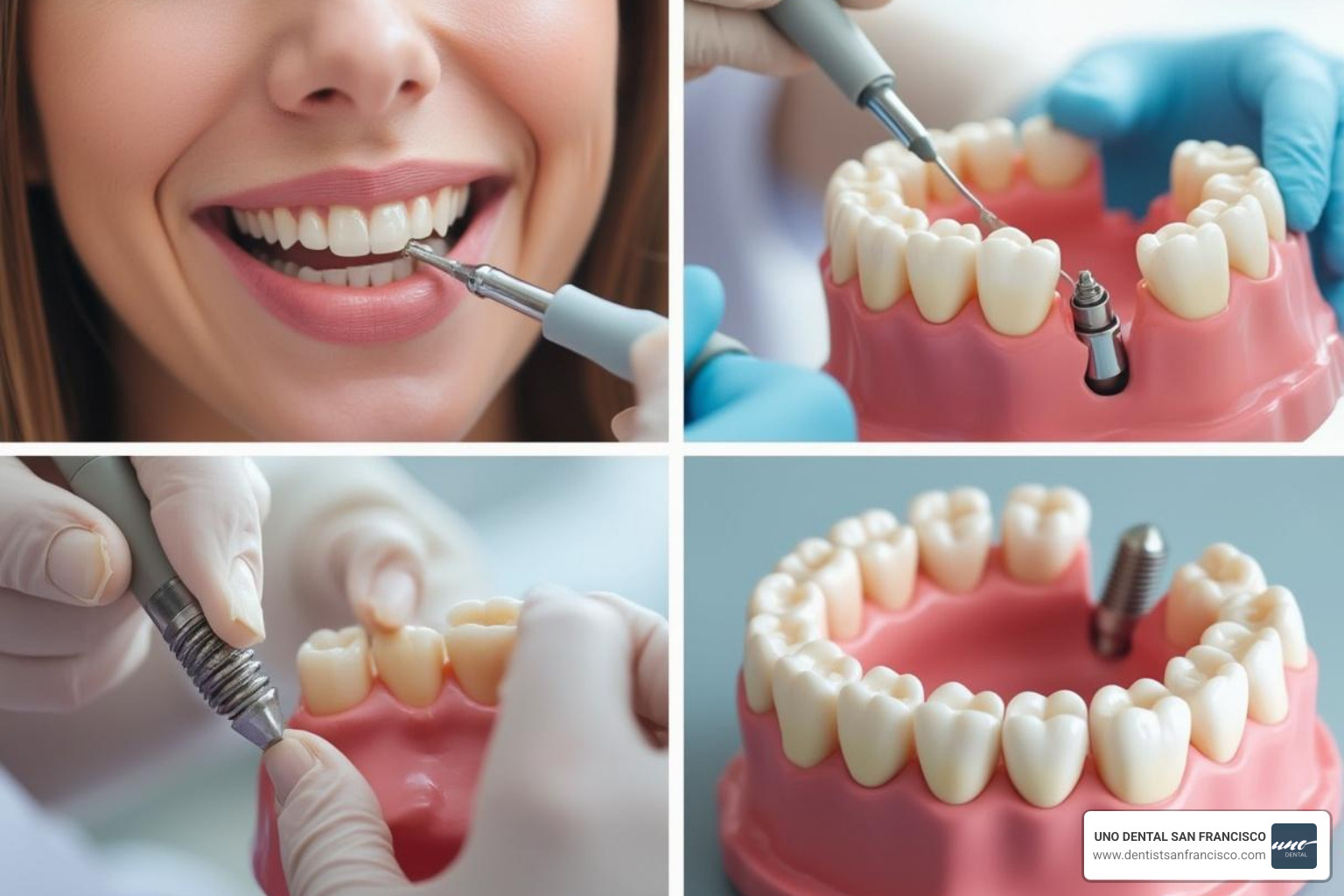 Collage of a dental filling procedure, a dental crown placement, and a dental implant - what services does restorative dentistry include