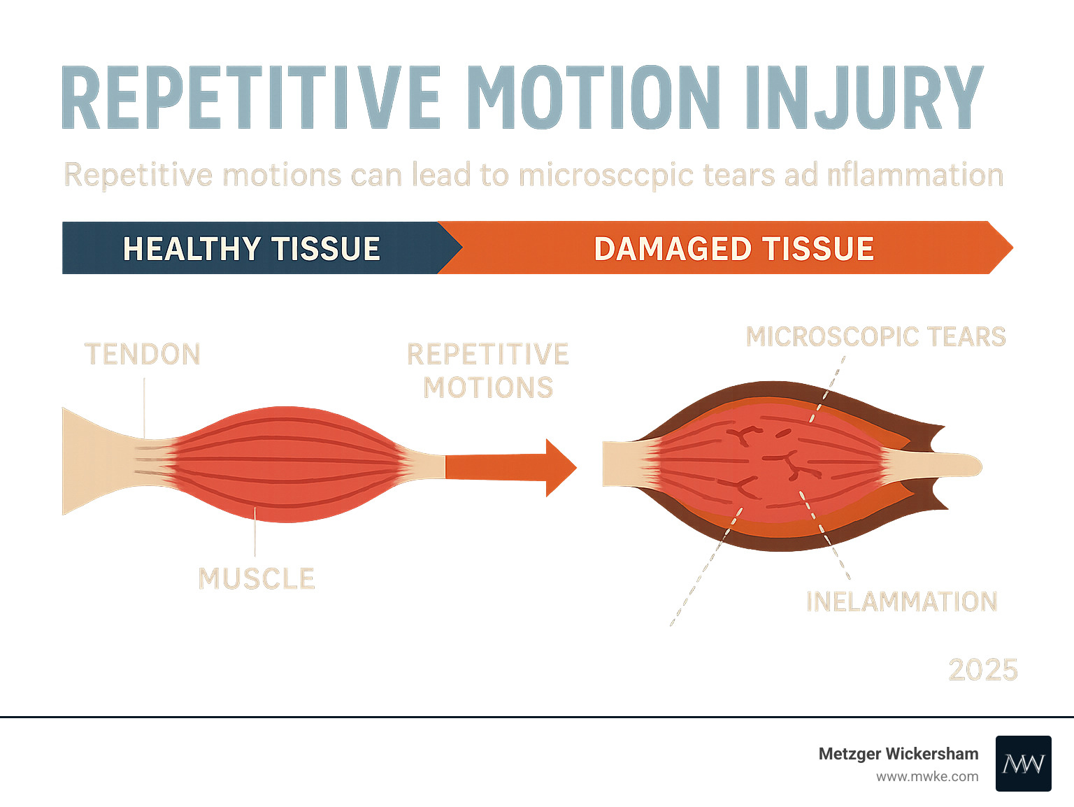 Infographic explaining how repetitive motions lead to microscopic tears and inflammation in tendons and muscles, showing a progression from healthy tissue to damaged tissue due to overuse - Repetitive motion injury infographic 