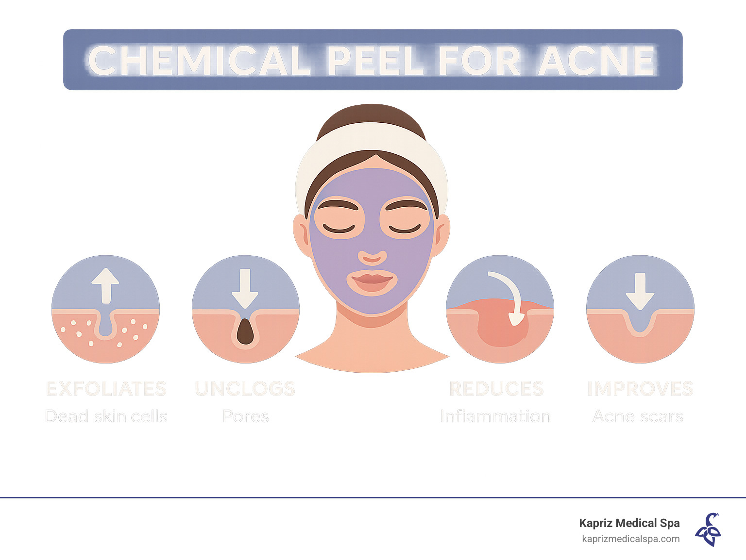 Infographic explaining how chemical peels treat acne by exfoliating, unclogging pores, reducing inflammation, and improving scars - chemical peel for acne infographic Infographic explaining how chemical peels treat acne by exfoliating, unclogging pores, reducing inflammation, and improving scars - chemical peel for acne infographic