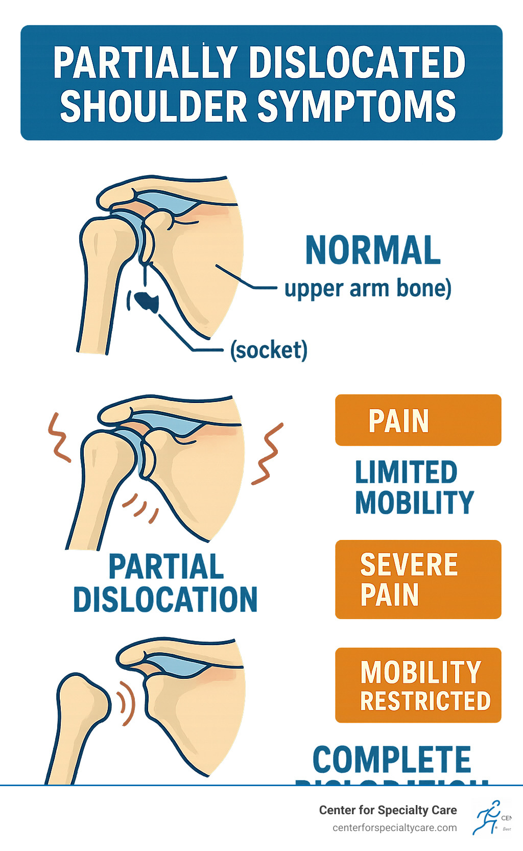 Partially Dislocated Shoulder Symptoms Uncover Pain 2025 Partially Dislocated Shoulder Symptoms Uncover Pain 2025