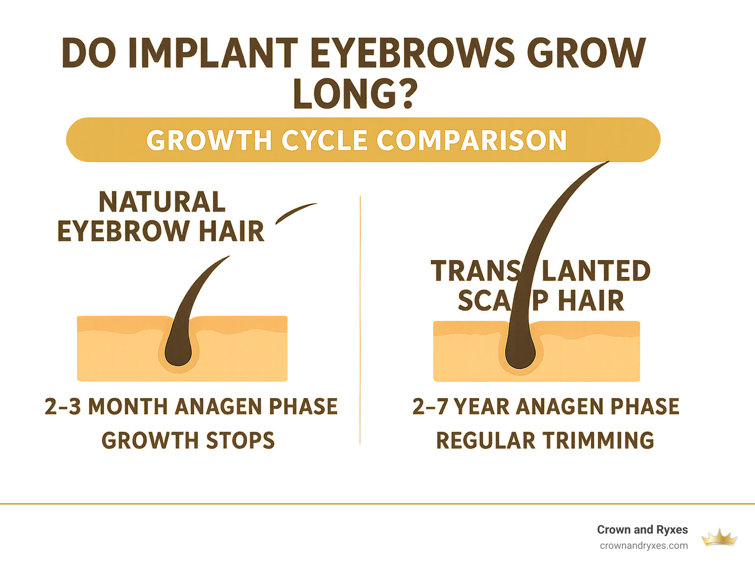 Infographic showing the growth cycle comparison between natural eyebrow hair (2-3 month anagen phase with growth stop) versus transplanted scalp hair (continuous 2-7 year anagen phase requiring regular trimming) - do implant eyebrows grow long infographic Infographic showing the growth cycle comparison between natural eyebrow hair (2-3 month anagen phase with growth stop) versus transplanted scalp hair (continuous 2-7 year anagen phase requiring regular trimming) - do implant eyebrows grow long infographic