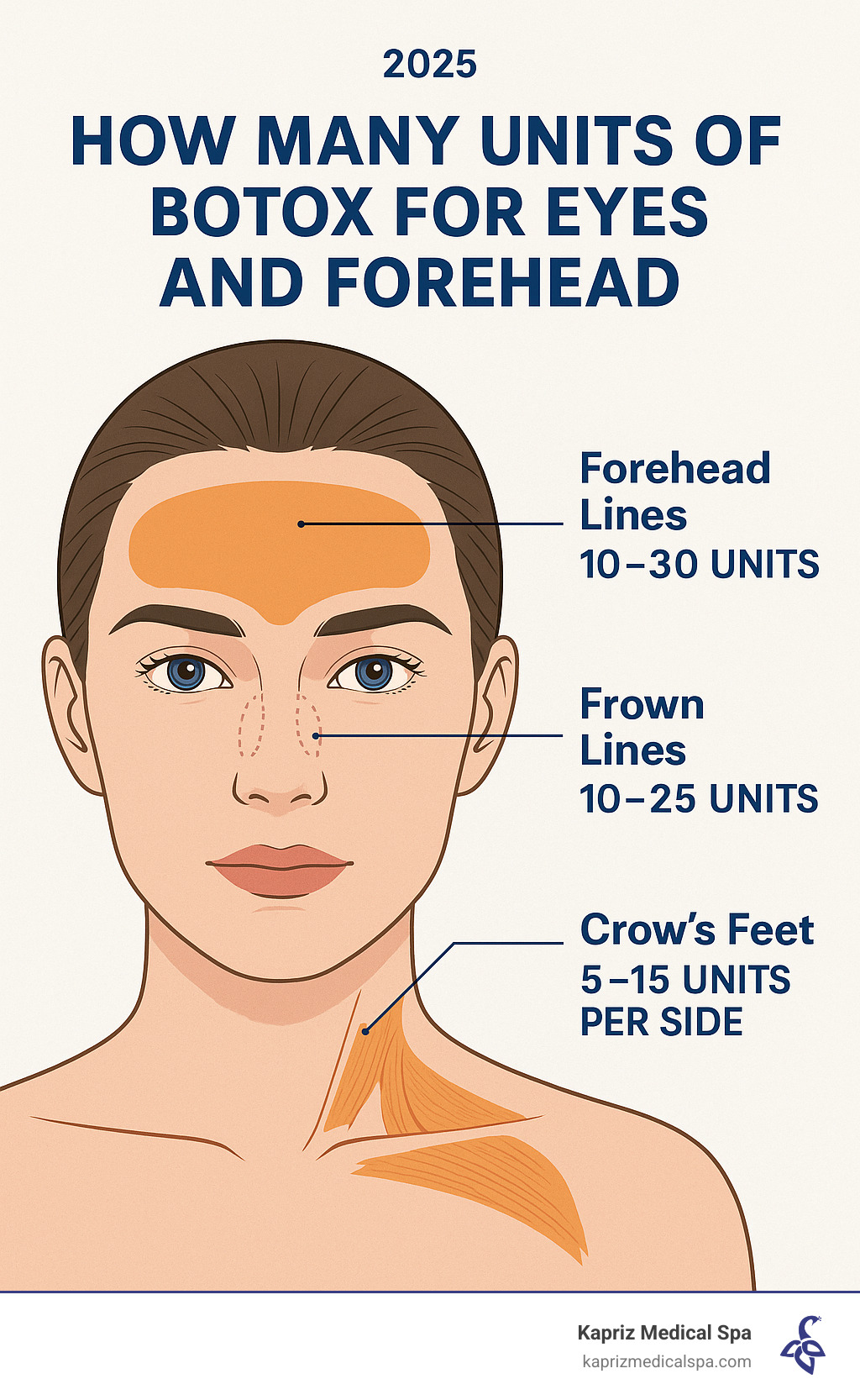 Infographic showing Botox injection areas on the upper face including forehead horizontal lines requiring 10-30 units, glabellar frown lines between eyebrows needing 10-25 units, and crow's feet around the eyes requiring 5-15 units per side, with anatomical muscle locations marked - how many units of botox for eyes and forehead infographic Infographic showing Botox injection areas on the upper face including forehead horizontal lines requiring 10-30 units, glabellar frown lines between eyebrows needing 10-25 units, and crow's feet around the eyes requiring 5-15 units per side, with anatomical muscle locations marked - how many units of botox for eyes and forehead infographic