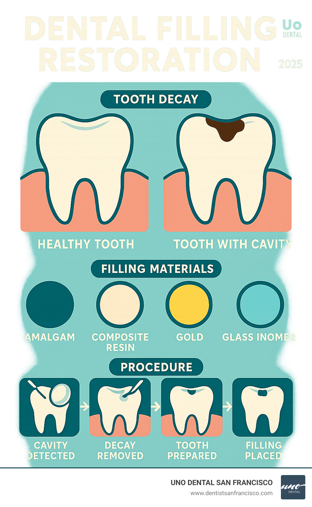 Comprehensive infographic showing the dental filling restoration process from initial cavity detection through material placement, including visual comparison of healthy tooth structure versus decayed tooth requiring restoration, different filling material options, and step-by-step procedure timeline - dental filling restoration infographic 